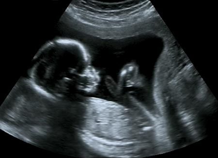 ultrasound-image - Greater New Haven OB/GYN